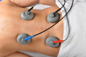 elektrotherapie